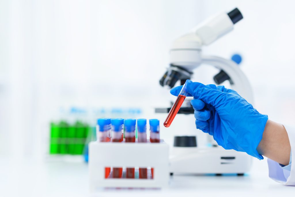 Which is the Top Blood Testing Laboratory in Dubai?